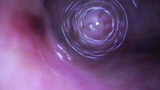 Fiberscope in urethral test tube